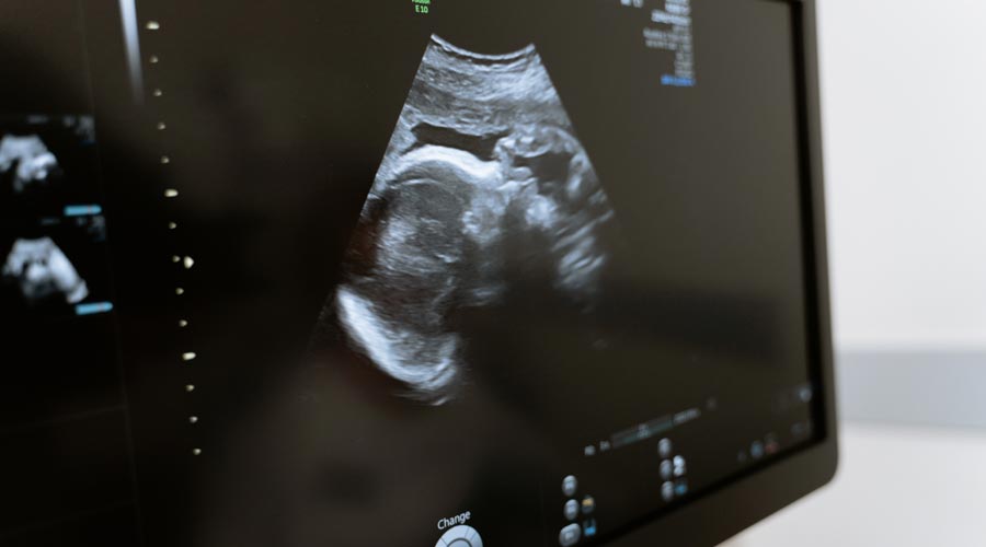 Kinderwunsch und Zyklusbeobachtung